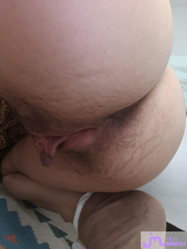 minous de labia