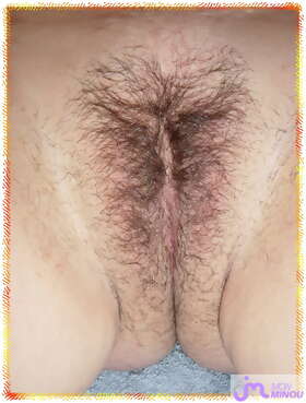 Photos de minous : rasage