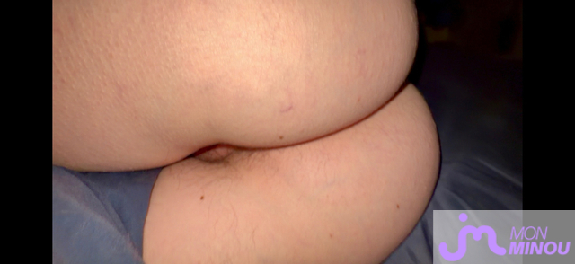minous de PenileImplantX 
