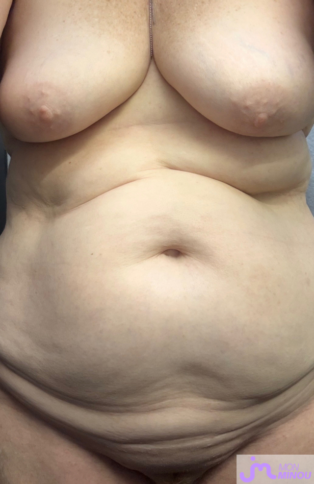 minous de Mau6950